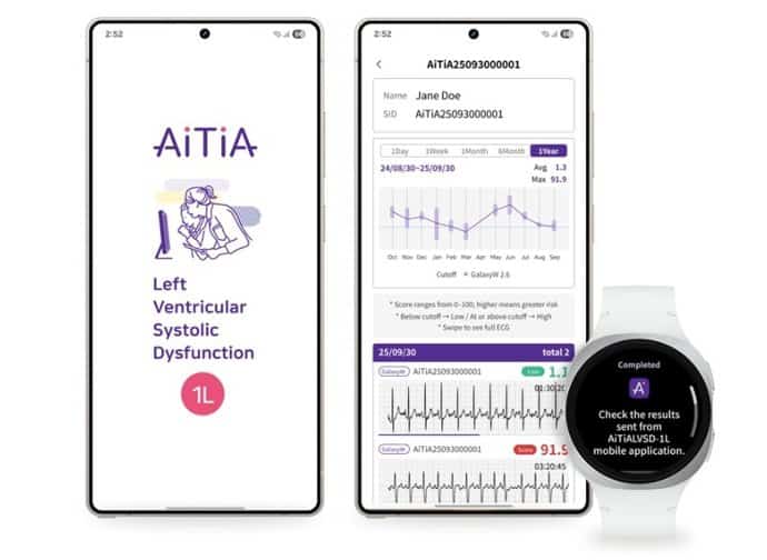 Así podrán los relojes de Samsung ayudarte a controlar una peligrosa condición relacionada con la insuficiencia cardíaca